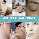 Laser de CO2 – Fracionado no rejuvenescimento