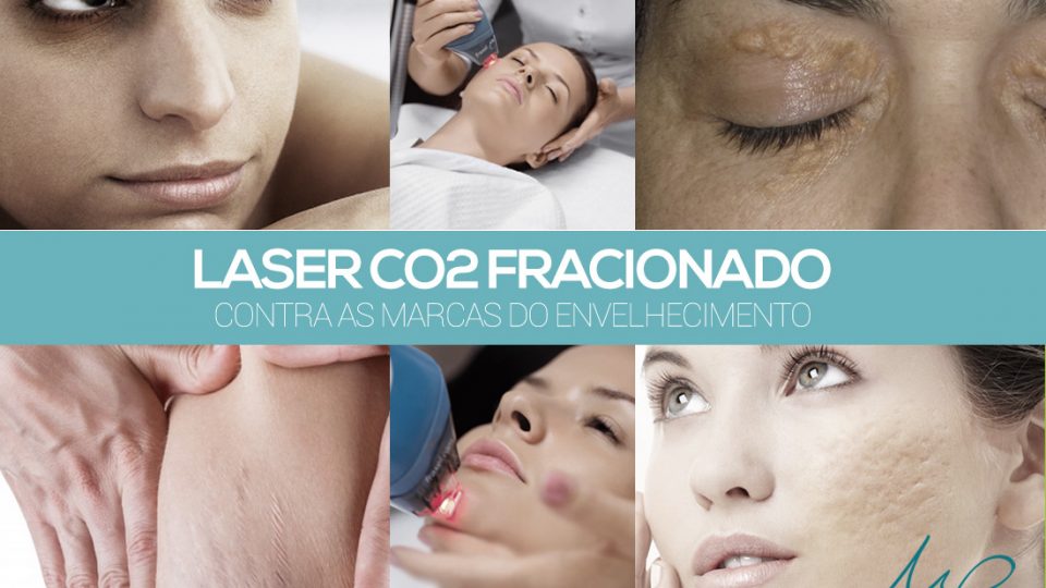 Laser de CO2